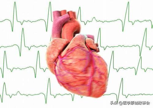 心脏信号4,揭秘现代心血管疾病的防治之道